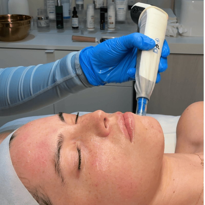 Aesthetic practitioner wearing blue gloves uses a handheld wand on a client’s face during a facial treatment in a clinic setting