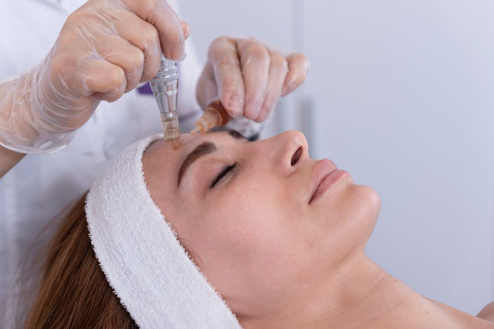 Microneedling – EZ PRF & PRF Gel