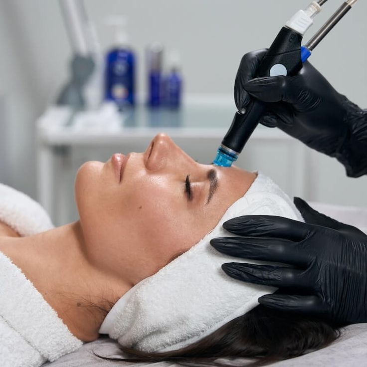 Diamond Microdermabrasion